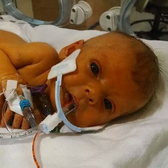 Father of Deceased Baby Girl Asked Strangers To Remove Medical Tubes Out Of Her Only Picture, Here's The Response