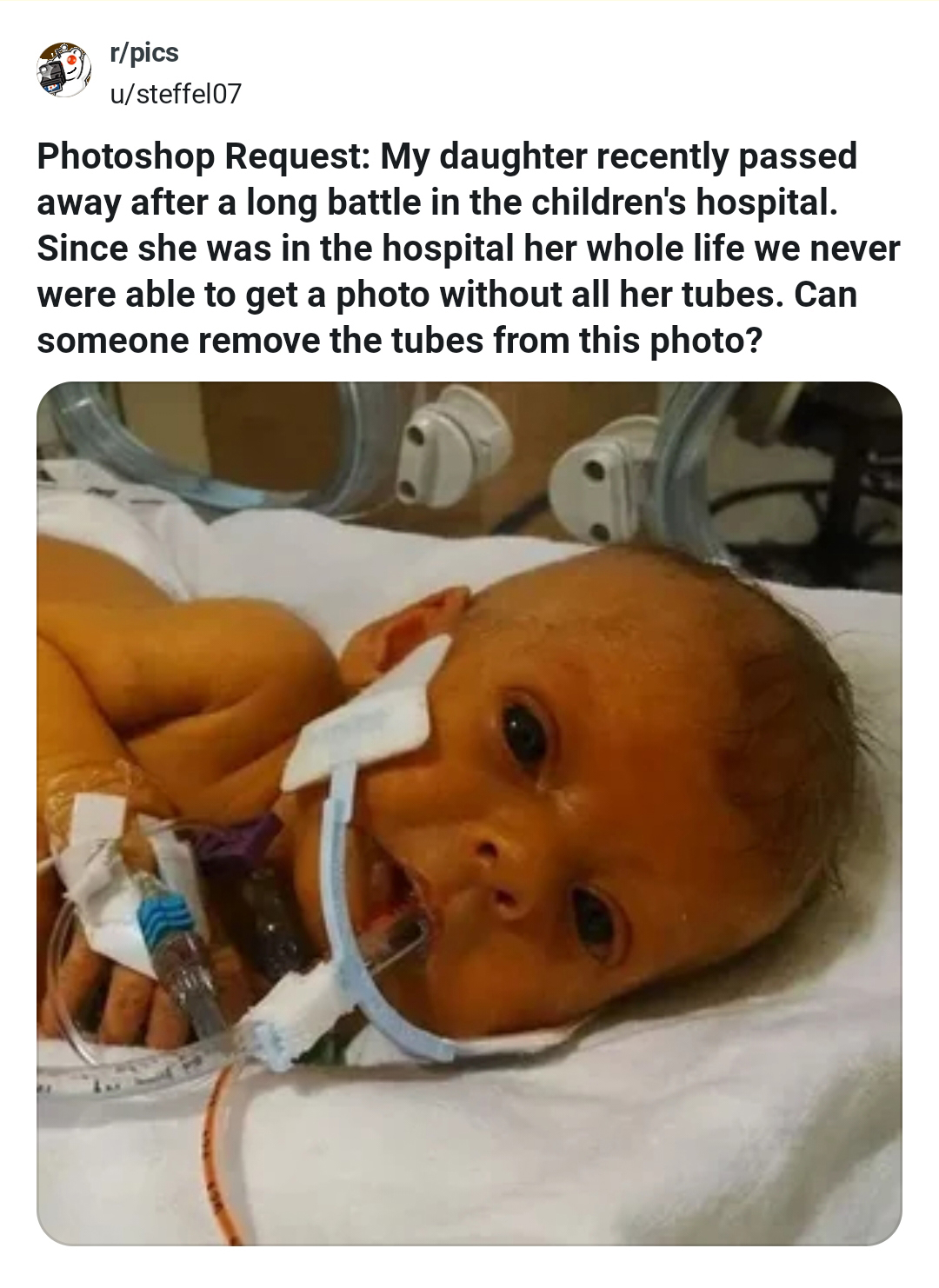Photoshop request to edit baby girl's hospital photo by removing medical tubes